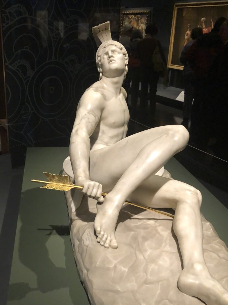 Wounded Achilles